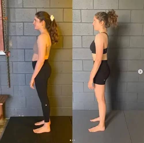 Before and after posture improvement using an adjustable posture corrector for men and women by Dropdash
